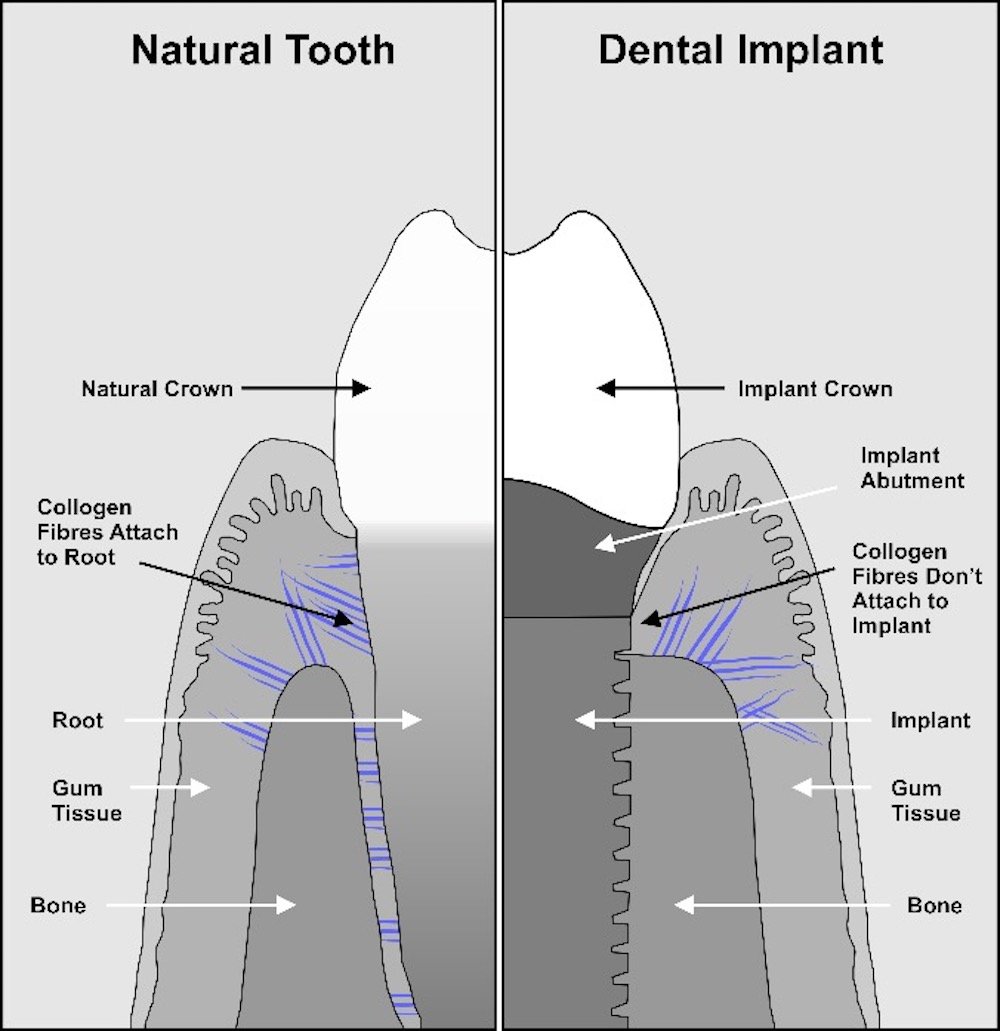 Lubbock Dental Implant Center